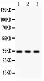 Anti-Caspase-7 Picoband antibody, PB9369, Western blotting All lanes: Anti Caspase-7(PB9369) at 0.5ug/ml Lane 1: A549 Whole Cell Lysate at 40ug Lane 2: Rat Spleen Tissue Lysate at 50ug Lane 3: Rat Lung Tissue Lysate at 50ug Predicted bind size: 34KD Observed bind size: 34KD