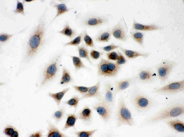 IHC analysis of Peroxiredoxin 4 using anti-Peroxiredoxin 4 antibody (PB9383). Peroxiredoxin 4 was detected in immunocytochemical section of A549 Cell. Enzyme antigen retrieval was performed using IHC enzyme antigen retrieval reagent (AR0022) for 15 mins. The cells were blocked with 10% goat serum. And then incubated with 1μg/ml rabbit anti-Peroxiredoxin 4 Antibody (PB9383) overnight at 4°C. Biotinylated goat anti-rabbit IgG was used as secondary antibody and incubated for 30 minutes at 37°C. The section was developed using Strepavidin-Biotin-Complex (SABC)(Catalog # SA1022) with DAB as the chromogen.