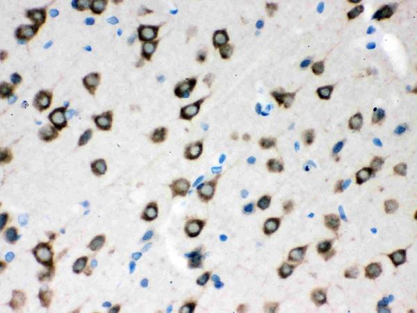 Anti-SMN1/2 Picoband antibody, PB9398,IHC(P) IHC(P): Rat Brain Tissue