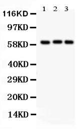 Western blot analysis of Heparanase 1 using anti-Heparanase 1 antibody (PB9427).