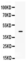 Western blot analysis of SP5 using anti-SP5 antibody (PB9443).