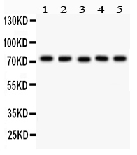 Western blot analysis of EED using anti-EED antibody (PB9581).