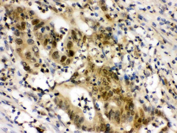 IHC analysis of EIF6 using anti-EIF6 antibody (PB9582).