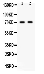 Western blot analysis of Frizzled homolog 1 using anti-Frizzled homolog 1 antibody (PB9594).