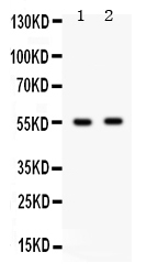 Western blot analysis of GABRB3 using anti-GABRB3 antibody (PB9595).