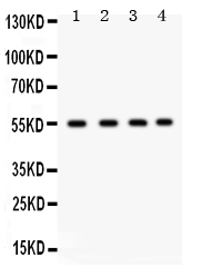 Western blot analysis of GJA3 using anti-GJA3 antibody (PB9596).