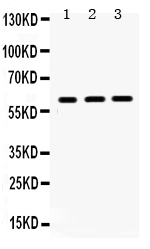 Western blot analysis of HNF1 beta using anti-HNF1 beta antibody (PB9597).