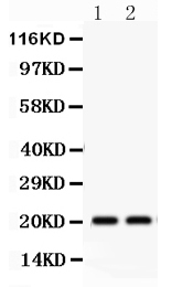 Western blot analysis of HSPB2 using anti-HSPB2 antibody (PB9598).