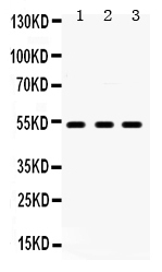 Western blot analysis of 5HT2A Receptor using anti-5HT2A Receptor antibody (PB9599). Electrophoresis was performed on a 5-20% SDS-PAGE gel at 70V (Stacking gel) / 90V (Resolving gel) for 2-3 hours. The sample well of each lane was loaded with 50ug of sample under reducing conditions. Lane 1: Rat Brain Tissue Lysate, Lane 2: Rat Testis Tissue Lysate, Lane 3: U87 Whole Cell Lysate. After Electrophoresis, proteins were transferred to a Nitrocellulose membrane at 150mA for 50-90 minutes. Blocked the membrane with 5% Non-fat Milk/ TBS for 1.5 hour at RT. The membrane was incubated with rabbit anti-5HT2A Receptor antigen affinity purified polyclonal antibody (Catalog # PB9599) at 0.5 μg/mL overnight at 4°C, then washed with TBS-0.1%Tween 3 times with 5 minutes each and probed with a goat anti-rabbit IgG-HRP secondary antibody at a dilution of 1:10000 for 1.5 hour at RT. The signal is developed using an Enhanced Chemiluminescent detection (ECL) kit (Catalog # EK1002) with Tanon 5200 system. A specific band was detected for 5HT2A Receptor at approximately 53KD. The expected band size for 5HT2A Receptor is at 53KD.