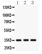 Western blot analysis of IGFBP2 using anti-IGFBP2 antibody (PB9605).