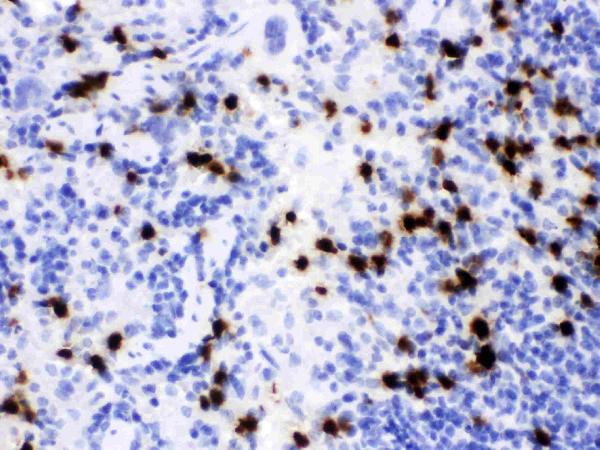 IHC analysis of Lipocalin 2 using anti-Lipocalin 2 antibody (PB9608).