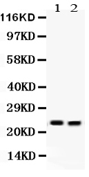 Western blot analysis of Lipocalin 2 using anti-Lipocalin 2 antibody (PB9609).