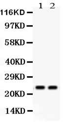 Western blot analysis of Lipocalin 2 using anti-Lipocalin 2 antibody (PB9610).