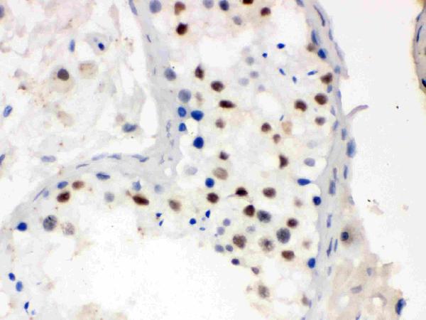 IHC analysis of MNAT1 using anti-MNAT1 antibody (PB9615).