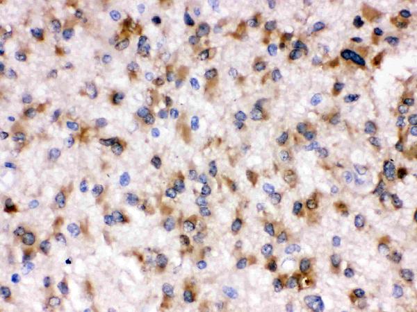 IHC analysis of Otoferlin using anti-Otoferlin antibody (PB9616).