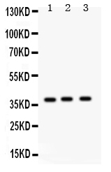 Western blot analysis of Surfactant protein D using anti-Surfactant protein D antibody (PB9617).