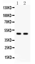 Western blot analysis of SOX4 using anti-SOX4 antibody (PB9618). Electrophoresis was performed on a 5-20% SDS-PAGE gel at 70V (Stacking gel) / 90V (Resolving gel) for 2-3 hours. The sample well of each lane was loaded with 50ug of sample under reducing conditions. Lane 1: MCF-7 Whole Cell Lysate, Lane 2: 293T Whole Cell Lysate. After Electrophoresis, proteins were transferred to a Nitrocellulose membrane at 150mA for 50-90 minutes. Blocked the membrane with 5% Non-fat Milk/ TBS for 1.5 hour at RT. The membrane was incubated with rabbit anti-SOX4 antigen affinity purified polyclonal antibody (Catalog # PB9618) at 0.5 μg/mL overnight at 4°C, then washed with TBS-0.1%Tween 3 times with 5 minutes each and probed with a goat anti-rabbit IgG-HRP secondary antibody at a dilution of 1:10000 for 1.5 hour at RT. The signal is developed using an Enhanced Chemiluminescent detection (ECL) kit (Catalog # EK1002) with Tanon 5200 system. A specific band was detected for SOX4 at approximately 47KD. The expected band size for SOX4 is at 47KD.