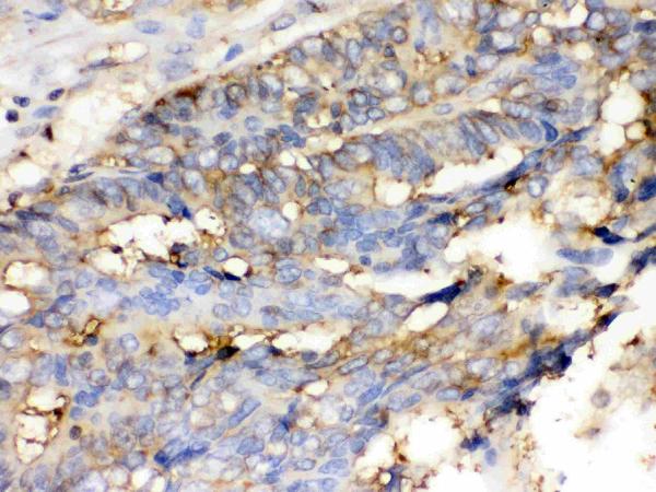 IHC analysis of Cofilin using anti-Cofilin antibody (PB9620).