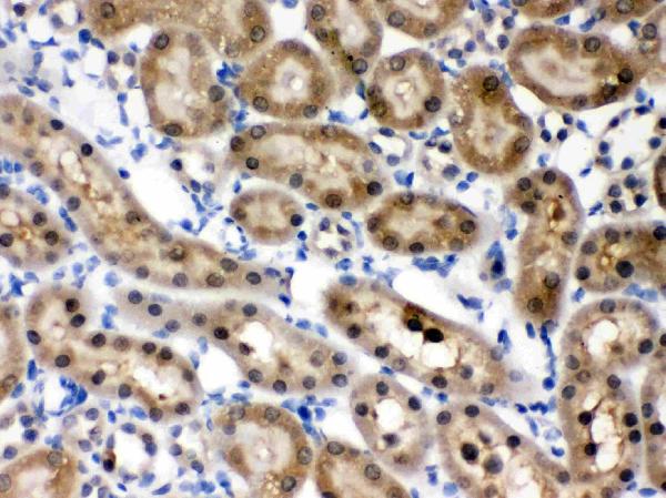 IHC analysis of HINT1 using anti-HINT1 antibody (PB9632).