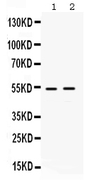 Western blot analysis of HSF4 using anti-HSF4 antibody (PB9634).