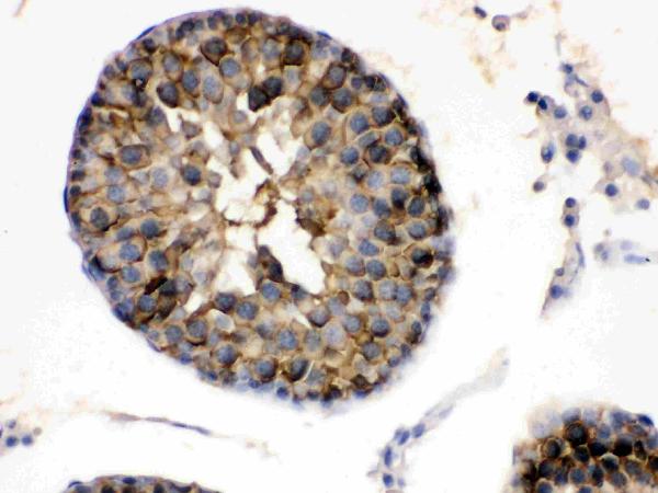 IHC analysis of Hsp90 alpha using anti-Hsp90 alpha antibody (PB9635).