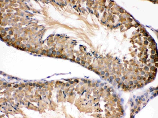 IHC analysis of HSP90AB1 using anti-HSP90AB1 antibody (PB9636). HSP90AB1 was detected in paraffin-embedded section of mouse testis tissues. Heat mediated antigen retrieval was performed in citrate buffer (pH6, epitope retrieval solution) for 20 mins. The tissue section was blocked with 10% goat serum. The tissue section was then incubated with 1μg/ml rabbit anti-HSP90AB1 Antibody (PB9636) overnight at 4°C. Biotinylated goat anti-rabbit IgG was used as secondary antibody and incubated for 30 minutes at 37°C. The tissue section was developed using Strepavidin-Biotin-Complex (SABC)(Catalog # SA1022) with DAB as the chromogen.