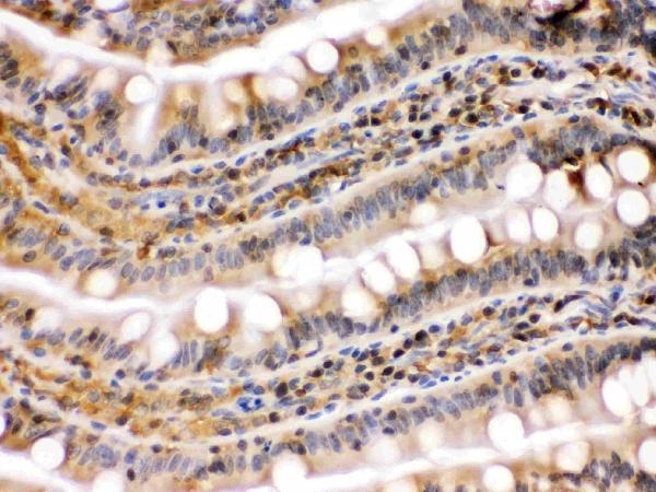 IHC analysis of HSP90AB1 using anti-HSP90AB1 antibody (PB9636). HSP90AB1 was detected in paraffin-embedded section of rat intestine tissues. Heat mediated antigen retrieval was performed in citrate buffer (pH6, epitope retrieval solution) for 20 mins. The tissue section was blocked with 10% goat serum. The tissue section was then incubated with 1μg/ml rabbit anti-HSP90AB1 Antibody (PB9636) overnight at 4°C. Biotinylated goat anti-rabbit IgG was used as secondary antibody and incubated for 30 minutes at 37°C. The tissue section was developed using Strepavidin-Biotin-Complex (SABC)(Catalog # SA1022) with DAB as the chromogen.