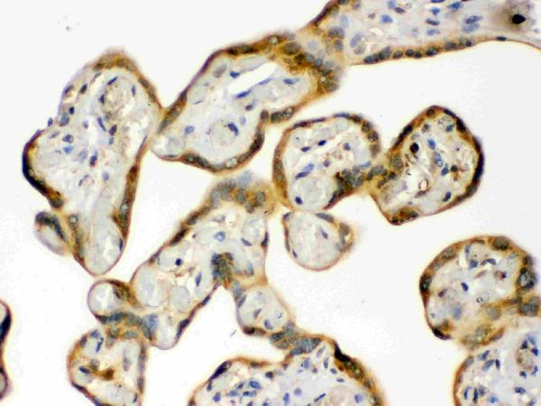 IHC analysis of HSP90AB1 using anti-HSP90AB1 antibody (PB9636). HSP90AB1 was detected in paraffin-embedded section of human placenta tissues. Heat mediated antigen retrieval was performed in citrate buffer (pH6, epitope retrieval solution) for 20 mins. The tissue section was blocked with 10% goat serum. The tissue section was then incubated with 1μg/ml rabbit anti-HSP90AB1 Antibody (PB9636) overnight at 4°C. Biotinylated goat anti-rabbit IgG was used as secondary antibody and incubated for 30 minutes at 37°C. The tissue section was developed using Strepavidin-Biotin-Complex (SABC)(Catalog # SA1022) with DAB as the chromogen.