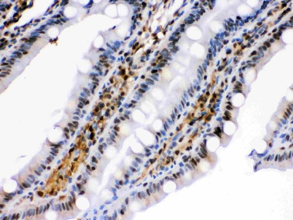 IHC analysis of HSPA2 using anti-HSPA2 antibody (PB9639).