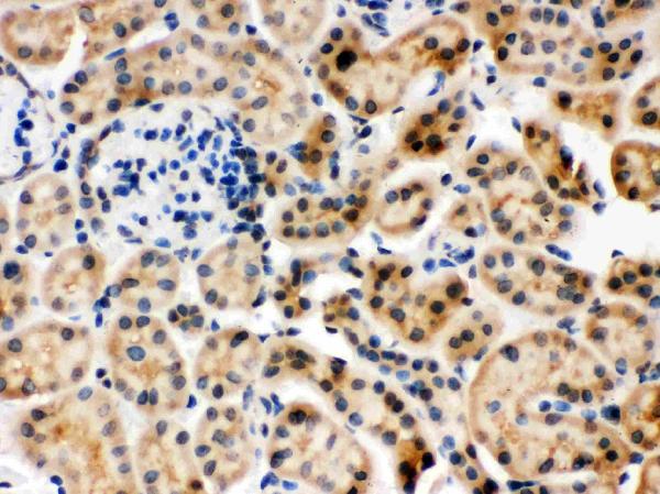 IHC analysis of Hsc70 using anti-Hsc70 antibody (PB9641).