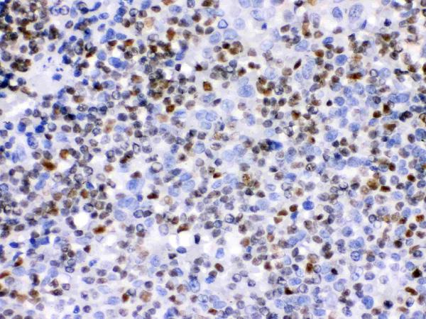 IHC analysis of Ikaros using anti-Ikaros antibody (PB9643).