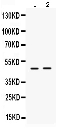 Western blot analysis of ING1 using anti-ING1 antibody (PB9644).