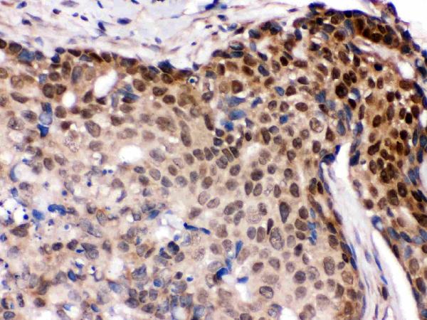 IHC analysis of IRF5 using anti-IRF5 antibody (PB9646).