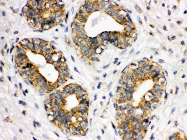 IHC analysis of ITGA2B using anti-ITGA2B antibody (PB9647).