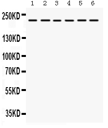 Western blot analysis of Integrin alpha 4 using anti-Integrin alpha 4 antibody (PB9648).