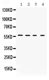 Western blot analysis of Kv1.2 using anti-Kv1.2 antibody (PB9649).