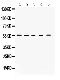 Western blot analysis of KCNA3 using anti-KCNA3 antibody (PB9650).