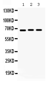 Western blot analysis of KCNA5 using anti-KCNA5 antibody (PB9651).