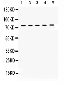 Western blot analysis of KIF3A using anti-KIF3A antibody (PB9654).