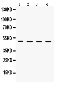 Western blot analysis of LCAT using anti-LCAT antibody (PB9657).