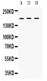 Western blot analysis of LIFR using anti-LIFR antibody (PB9661).