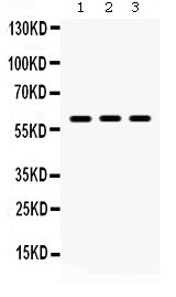 Western blot analysis of Lumican using anti-Lumican antibody (PB9662).