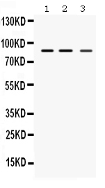 Western blot analysis of MEFV using anti-MEFV antibody (PB9667).