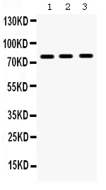 Western blot analysis of MMP-9 using anti-MMP-9 antibody (PB9669).