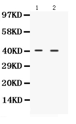 Western blot analysis of NDRG2 using anti-NDRG2 antibody (PB9672).