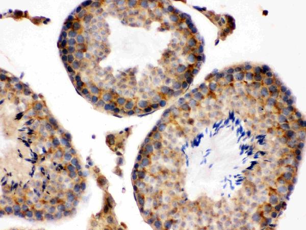 IHC analysis of S100A6 using anti-S100A6 antibody (PB9676). S100A6 was detected in paraffin-embedded section of Mouse Testis tissues. Heat mediated antigen retrieval was performed in citrate buffer (pH6, epitope retrieval solution) for 20 mins. The tissue section was blocked with 10% goat serum. The tissue section was then incubated with 1μg/ml rabbit anti-S100A6 Antibody (PB9676) overnight at 4°C. Biotinylated goat anti-rabbit IgG was used as secondary antibody and incubated for 30 minutes at 37°C. The tissue section was developed using Strepavidin-Biotin-Complex (SABC)(Catalog # SA1022) with DAB as the chromogen.