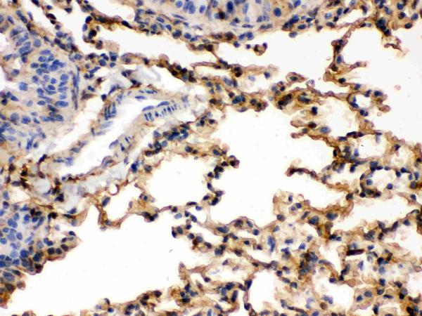 IHC analysis of S100A6 using anti-S100A6 antibody (PB9676). S100A6 was detected in paraffin-embedded section of Rat Lung tissues. Heat mediated antigen retrieval was performed in citrate buffer (pH6, epitope retrieval solution) for 20 mins. The tissue section was blocked with 10% goat serum. The tissue section was then incubated with 1μg/ml rabbit anti-S100A6 Antibody (PB9676) overnight at 4°C. Biotinylated goat anti-rabbit IgG was used as secondary antibody and incubated for 30 minutes at 37°C. The tissue section was developed using Strepavidin-Biotin-Complex (SABC)(Catalog # SA1022) with DAB as the chromogen.