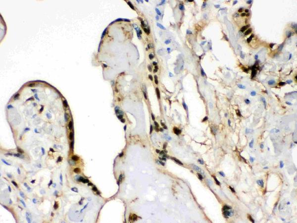 IHC analysis of S100A6 using anti-S100A6 antibody (PB9676). S100A6 was detected in paraffin-embedded section of Human Placenta tissues. Heat mediated antigen retrieval was performed in citrate buffer (pH6, epitope retrieval solution) for 20 mins. The tissue section was blocked with 10% goat serum. The tissue section was then incubated with 1μg/ml rabbit anti-S100A6 Antibody (PB9676) overnight at 4°C. Biotinylated goat anti-rabbit IgG was used as secondary antibody and incubated for 30 minutes at 37°C. The tissue section was developed using Strepavidin-Biotin-Complex (SABC)(Catalog # SA1022) with DAB as the chromogen.