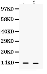 Western blot analysis of S100A9 using anti-S100A9 antibody (PB9677).