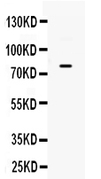 Western blot analysis of GRK using anti-GRK antibody (PB9682).